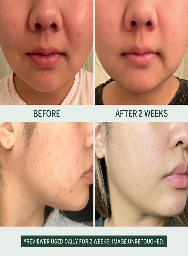 فايستوري غسول الوجه المرطب أوربان كالم من فيستوري للنساء، منظف جل لطيف للوجه مع خلاصة الكمثرى المخمرة وحمض LHA، غسول للوجه للبشرة الحساسة ومزيل مكياج يومي للبشرة الدهنية والجافة والمختلطة - 30 مل - Image 5